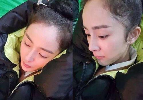 明星网红的发际线,时尚潮流下的健康挑战