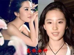 明星网红腿骨折图片,意外瞬间引发网友关注与热议