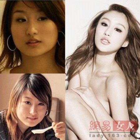 西安明星网红整容医院